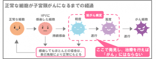 Hpv 検査